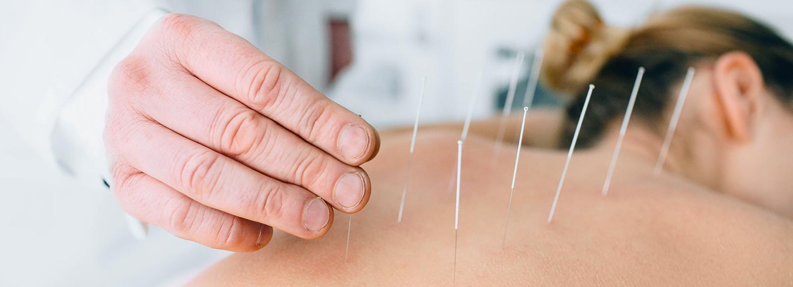 camberwell medical acupuncture